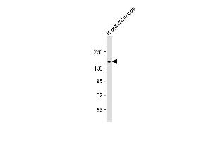 Anti-AGL Antibody (M15) at 1:1000 dilution + human skeletal muscle lysate Lysates/proteins at 20 μg per lane. (AGL 抗体  (N-Term))