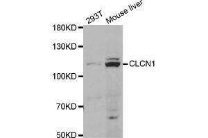 Western blot analysis of extracts of various cell lines, using CLCN1 antibody (ABIN5973365) at 1/1000 dilution. (CLCN1 抗体)
