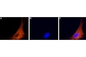 Expression of CaV2. (CACNA1B 抗体  (Intracellular))