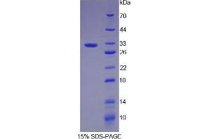 SDS-PAGE (SDS) image for Cytochrome P450, Family 1, Subfamily A, Polypeptide 1 (CYP1A1) (AA 1-250) protein (His tag) (ABIN1879411)