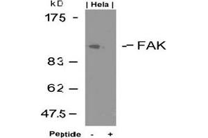 Image no. 3 for anti-PTK2 Protein tyrosine Kinase 2 (PTK2) (Tyr925) antibody (ABIN197349) (FAK 抗体  (Tyr925))