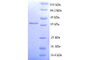 SDS-PAGE (SDS) image for NADH Dehydrogenase (Ubiquinone) 1 alpha Subcomplex, 3, 9kDa (NDUFA3) (AA 2-84) protein (GST tag) (ABIN5709997) (NDUFA3 Protein (AA 2-84) (GST tag))