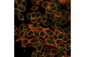 Immunofluorescence analysis of PFA-fixed HeLa cells. (MEF2B 抗体)