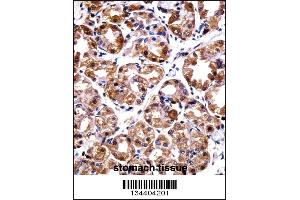POLI Antibody immunohistochemistry analysis in formalin fixed and paraffin embedded human stomach tissue followed by peroxidase conjugation of the secondary antibody and DAB staining. (POLI 抗体  (C-Term))
