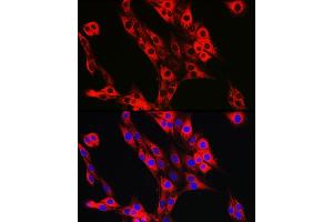 Immunofluorescence analysis of PC-12 cells using UFL1 Rabbit pAb (ABIN7271213) at dilution of 1:50 (40x lens).