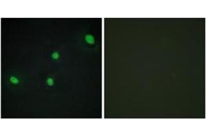 Immunofluorescence analysis of HepG2 cells, using CDCA4 Antibody. (CDCA4 抗体  (AA 121-170))