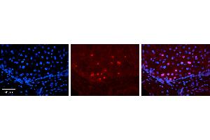 Rabbit Anti-ID2 Antibody   Formalin Fixed Paraffin Embedded Tissue: Human Liver Tissue Observed Staining: Nucleus in hepatocytes Primary Antibody Concentration: 1:100 Other Working Concentrations: N/A Secondary Antibody: Donkey anti-Rabbit-Cy3 Secondary Antibody Concentration: 1:200 Magnification: 20X Exposure Time: 0. (Id2 抗体  (Middle Region))