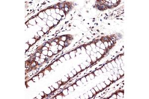 Immunohistochemistry of paraffin-embedded human colon using Carbonic Anhydrase 2 (C) Rabbit mAb (ABIN7266070) at dilution of 1:100 (40x lens). (CA2 抗体)