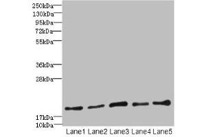 Western blot All lanes: PPIL3 antibody at 10 μg/mL Lane 1: U87 whole cell lysate Lane 2: HL60 whole cell lysate Lane 3: K562 whole cell lysate Lane 4: THP-1 whole cell lysate Lane 5: A549 whole cell lysate Secondary Goat polyclonal to rabbit IgG at 1/10000 dilution Predicted band size: 19 kDa Observed band size: 19 kDa (PPIL3 抗体  (AA 2-161))