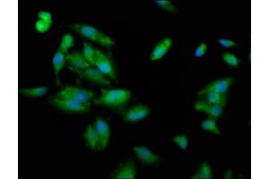 Immunofluorescence staining of Hela cells with ABIN7163687 at 1:100, counter-stained with DAPI. (PLEC 抗体  (AA 1744-1929))
