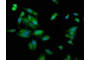 Immunofluorescence staining of Hela cells with ABIN7163687 at 1:100, counter-stained with DAPI. (PLEC 抗体  (AA 1744-1929))