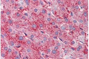Human Liver (formalin-fixed, paraffin-embedded) stained with APOC3 antibody ABIN462267 followed by biotinylated anti-goat IgG secondary antibody ABIN481715, alkaline phosphatase-streptavidin and chromogen. (APOC3 抗体)