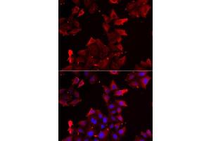 Immunofluorescence analysis of U2OS cells using PDLIM1 antibody. (PDLIM1 抗体  (AA 1-329))