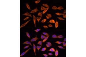 Immunofluorescence analysis of HeLa cells using ACLY Rabbit pAb (ABIN7265716) at dilution of 1:250 (40x lens). (ACLY 抗体  (AA 752-1101))