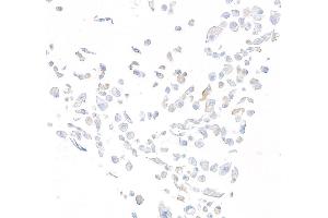 anti-Dipeptidyl-Peptidase 4 (DPP4) (AA 29-766) antibody