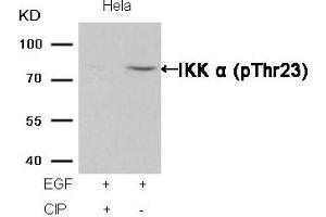 Western blot analysis of extracts from Hela cells, treated with EGF or calf intestinal phosphatase (CIP), using IKK α (Phospho-Thr23) Antibody. (IKK alpha 抗体  (pThr23))