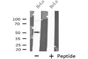 Western blot analysis of extracts from HeLa cells using GABRA6 antibody. (GABRA6 抗体  (N-Term))