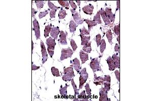 TrkA-p Antibody ((ABIN652381 and ABIN2841827))immunohistochemistry analysis in formalin fixed and paraffin embedded human skeletal muscle followed by peroxidase conjugation of the secondary antibody and DAB staining. (TrkA-pY791 (AA 769-796) 抗体)