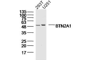 Lane 1: 293T; Lane 2: U251 cell lysates probed with BTN2A1 Polyclonal Antibody, Unconjugated (bs-20473R) at 1:300 overnight at 4˚C. (BTN2A1 抗体  (AA 101-200))