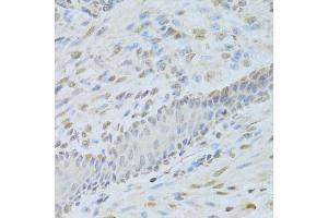 Immunohistochemistry of paraffin-embedded mouse esophagus using AIFM1 Antibody (ABIN5971393) at dilution of 1/200 (40x lens). (AIF 抗体)