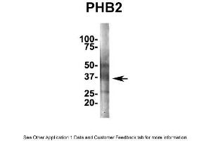 IP Suggested AntiPhb2 Antibody Positive Control: NT2 CELL/BRAIN TISSUE (Prohibitin 2 抗体  (Middle Region))