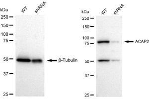 Western blotting analysis using ACAP2 antibody (ABIN7797642).