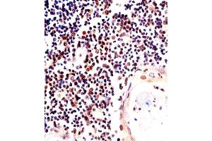 Paraformaldehyde-fixed, paraffin embedded Human Thymus tissue, Antigen retrieval by boiling in sodium citrate buffer (pH6. (H2AFX 抗体)