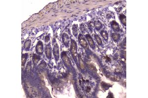 IHC analysis of IGF2R using anti-IGF2R antibody .