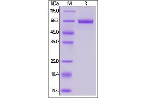 Biotinylated Human B7-H3, Fc,Avitag on  under reducing (R) condition. (CD276 Protein (CD276) (AA 29-245) (Fc Tag,AVI tag,Biotin))