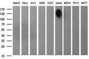 Image no. 1 for anti-Protein tyrosine Phosphatase, Receptor Type, C (PTPRC) antibody (ABIN1497331) (CD45 抗体)