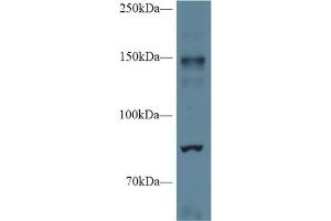 Western blot analysis of Mouse Cerebrum lysate, using Mouse NOS2 Antibody (1 µg/ml) and HRP-conjugated Goat Anti-Rabbit antibody ( (NOS2 抗体  (AA 43-213))