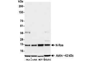 Western Blotting (WB) image for anti-HRas proto-oncogene, GTPase (HRAS) (AA 50-100) antibody (ABIN7795746)
