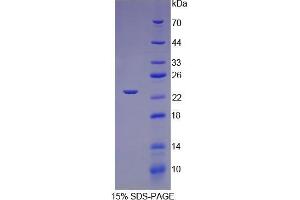 SDS-PAGE (SDS) image for Slow Skeletal Troponin I (TNNI1) (AA 1-187) protein (His tag) (ABIN1081038)