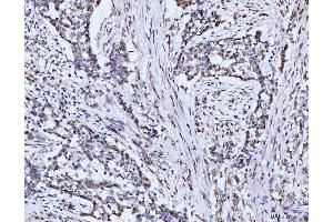 IHC analysis of 53BP1/TP53BP1 using anti-53BP1/TP53BP1 antibody (ABIN7599869).
