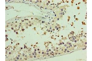 Immunohistochemistry of paraffin-embedded human testis tissue using ABIN7157782 at dilution of 1:100 (AASDHPPT 抗体  (AA 1-309))