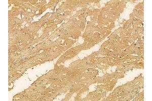 C2CD2 Mouse Monoclonal Antibody at 1/100 staining rat heart tissue by IHC-P. (C2CD2 抗体)
