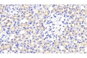 Detection of TNIP2 in Mouse Kidney Tissue using Polyclonal Antibody to Tumor Necrosis Factor Alpha Induced Protein 3 Interacting Protein 2 (TNIP2) (TNIP2 抗体  (AA 170-413))