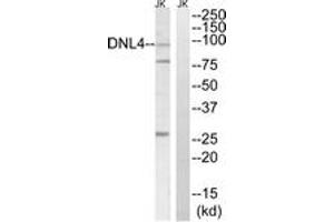 Western blot analysis of extracts from Jurkat cells, using DNL4 Antibody. (LIG4 抗体  (AA 591-640))