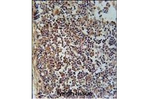 Immunohistochemistry (Paraffin-embedded Sections) (IHC (p)) image for anti-Family with Sequence Similarity 49, Member A (FAM49A) (AA 5-33), (N-Term) antibody (ABIN651554)