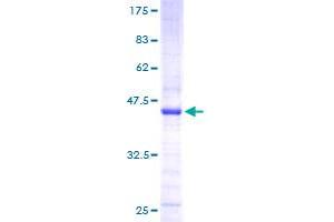 Image no. 1 for Protein-Kinase, Interferon-Inducible Double Stranded RNA Dependent Inhibitor, Repressor of (p58 Repressor) (PRKRIR) (AA 1-150) protein (GST tag) (ABIN1316308)