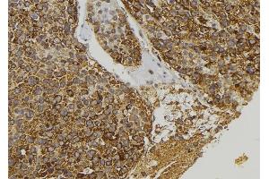 ABIN6273393 at 1/100 staining Human pancreas tissue by IHC-P. (CCL23 抗体)