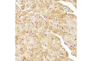 Immunohistochemistry of paraffin-embedded mouse heart using ACTN1 antibody at dilution of 1:100 (400x lens). (ACTN1 抗体)