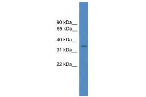 WB Suggested Anti-FLJ36070 Antibody Titration: 0. (FLJ36070 (Middle Region) 抗体)
