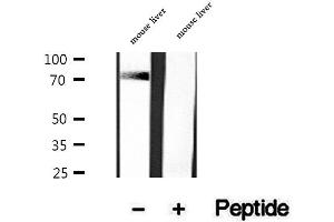 Western blot analysis of extracts of mouse liver tissue, using DNAJC10 antibody. (DNAJC10 抗体  (C-Term))