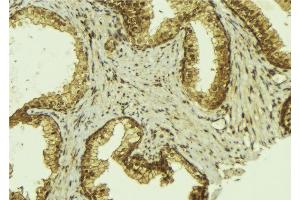 ABIN6274193 at 1/100 staining Mouse colon tissue by IHC-P. (TFE3 抗体  (Internal Region))