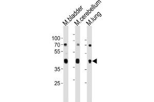 Western Blotting (WB) image for anti-Cholecystokinin A Receptor (CCKAR) antibody (ABIN3004717) (CCKAR 抗体)