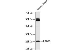 Western blot analysis of extracts of Mouse heart, using R antibody (ABIN7269800) at 1:1000 dilution.
