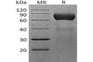 Ectonucleoside Triphosphate diphosphohydrolase 2 (ENTPD2) protein (His tag)