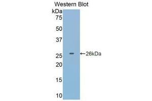 Detection of Recombinant GSTp, Human using Monoclonal Antibody to Glutathione S Transferase Pi (GSTp) (GSTP1 抗体  (AA 1-210))