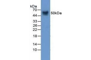 Detection of Vaspin in Mouse Skin Tissue using Polyclonal Antibody to Visceral Adipose Tissue Derived Serine Protease Inhibitor (Vaspin) (SERPINA12 抗体  (AA 71-148))